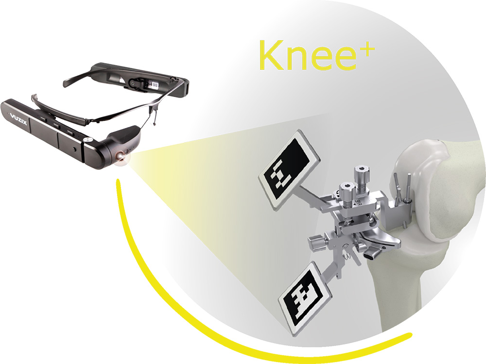 Pixee Medical Knee+ - Medix